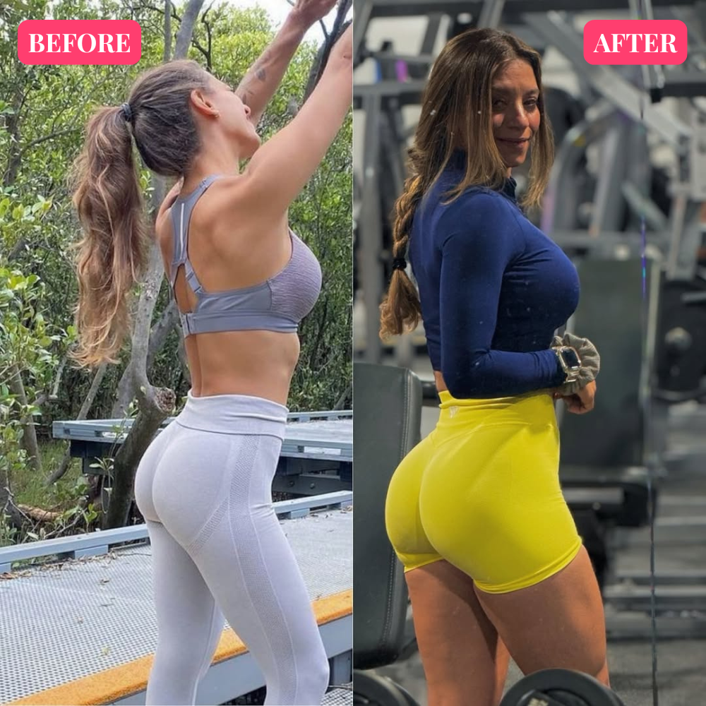 BBL Boost™ Creatine Gummies