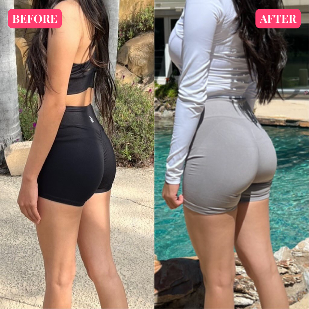 BBL Boost™ Creatine Gummies